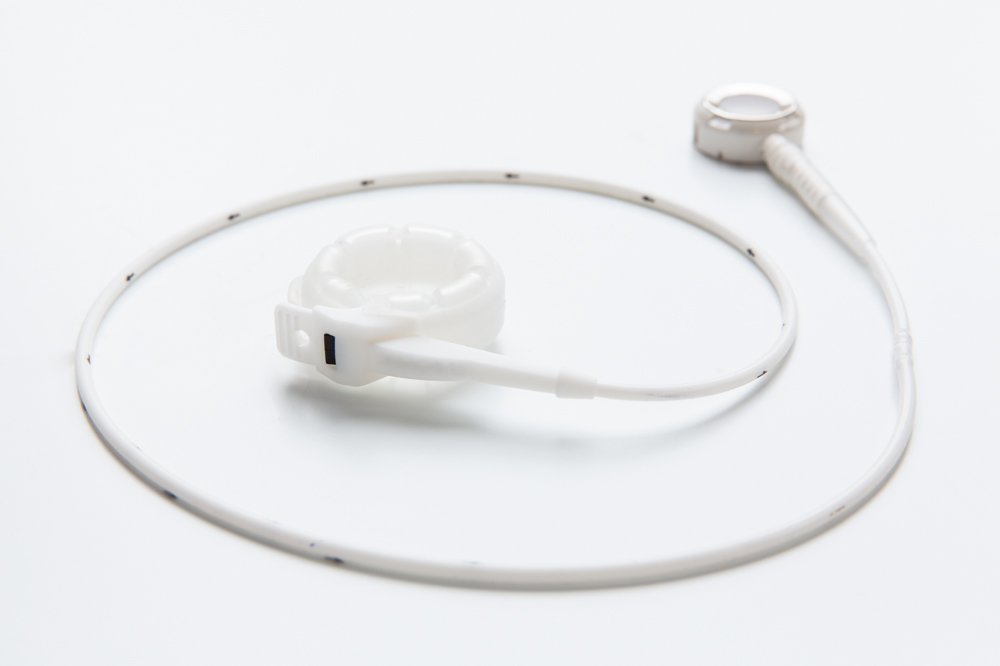 The LAPBAND® System Your Health Hub General Practice & Allied Health